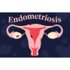 Endometriosis Management